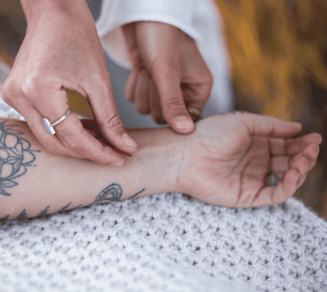 Acupuncture