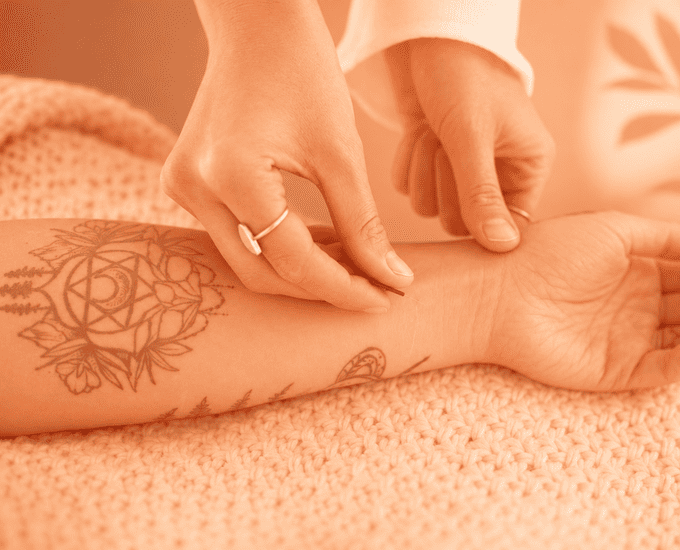 Acupuncture