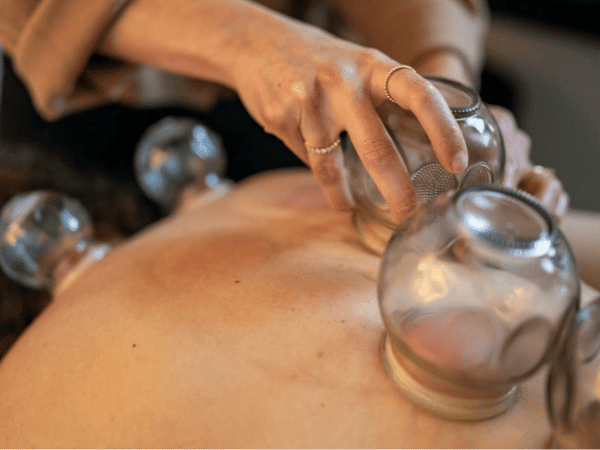 Cupping